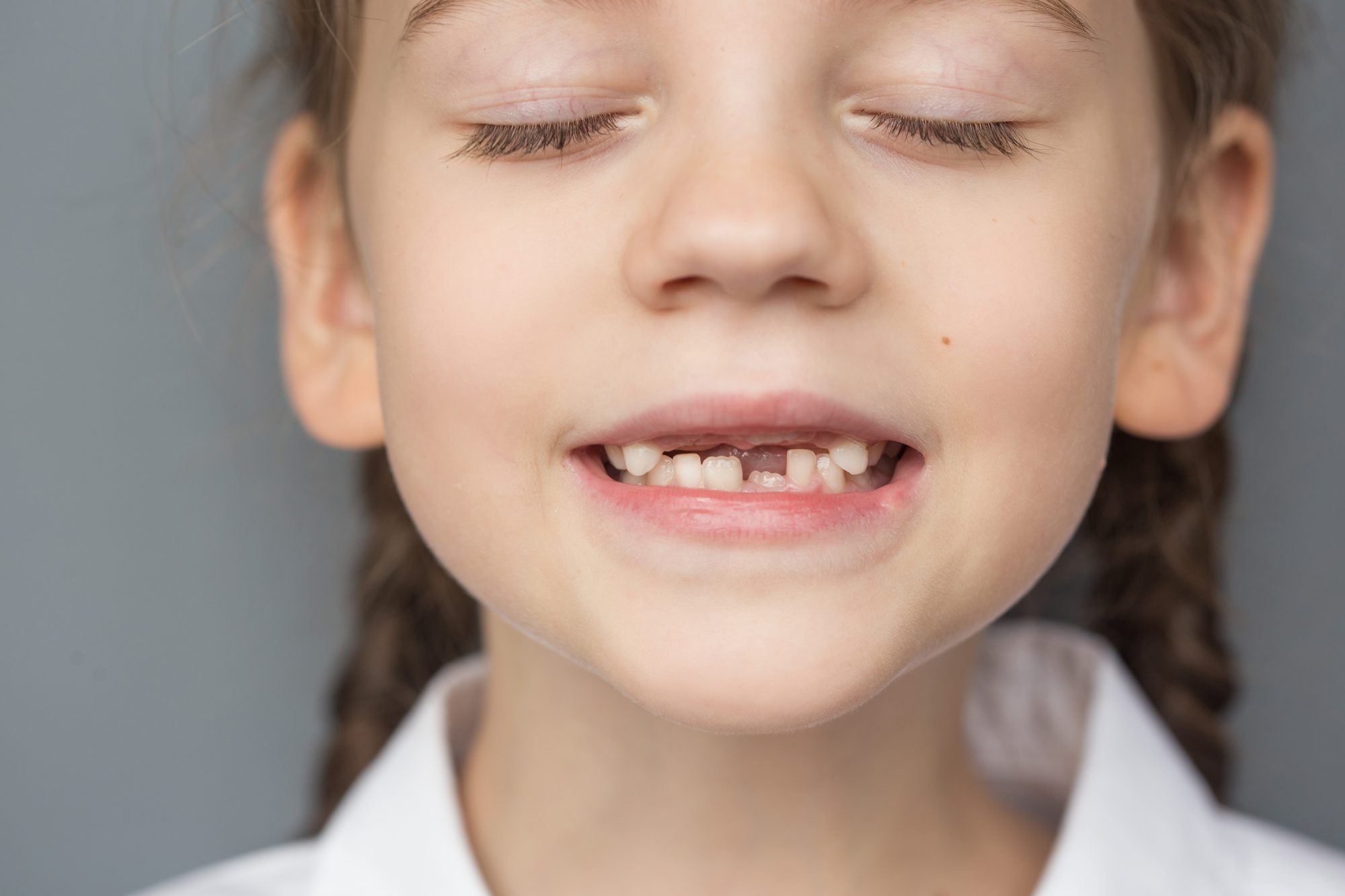 Why Has Your Child’s Permanent Tooth Not Come In